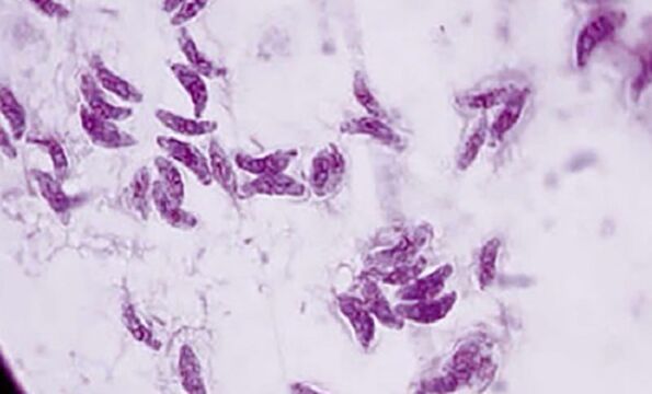 პროტოზოული პარაზიტი toxoplasma gondii ტოქსოპლაზმოზის გამომწვევი აგენტი