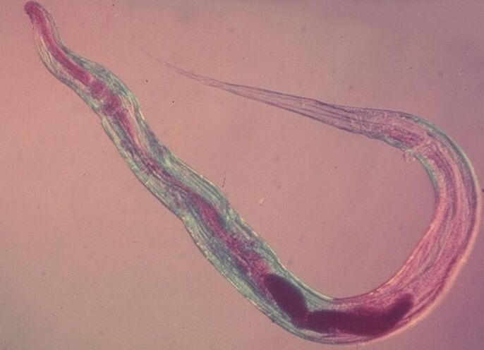 Pinworm მიკროსკოპის ქვეშ