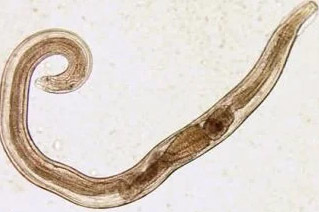 ადამიანის პარაზიტების pinworm